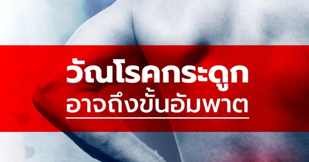 วัณโรคกระดูก อาจถึงขั้นอัมพาต