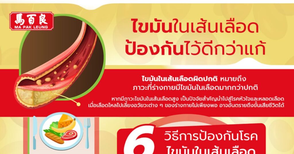 ไขมันในเส้นเลือด ป้องกันไว้ดีกว่าแก้