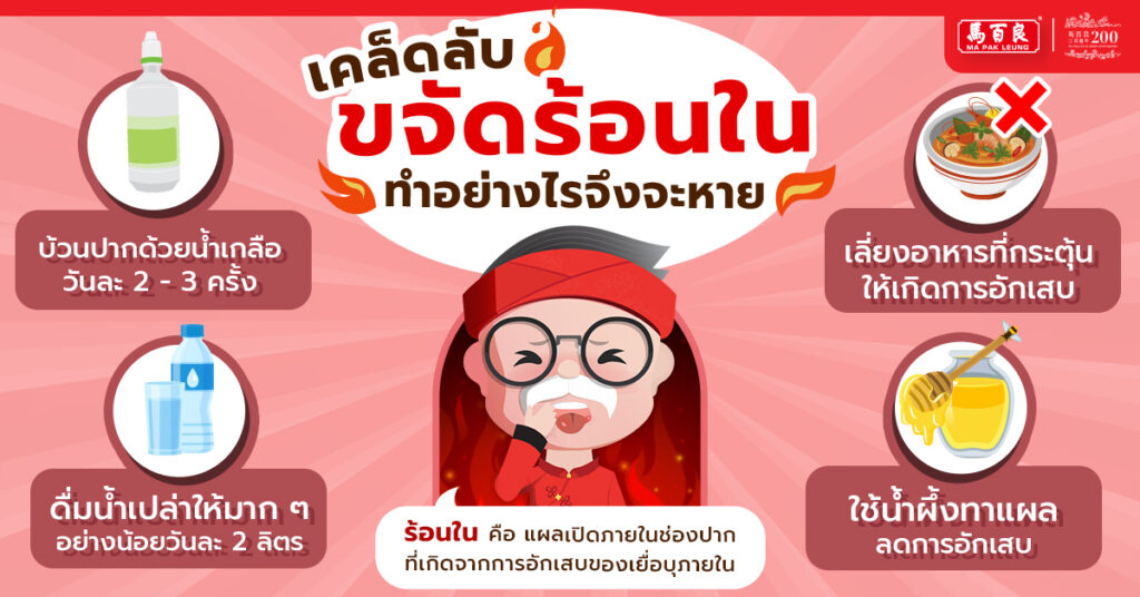 MPLM65 Post 09 1200x628px