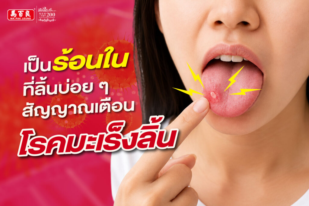 เป็นร้อนในที่ลิ้นบ่อย ๆ สัญญาณเตือน โรคมะเร็งลิ้น ! 3 เป็นร้อนในที่ลิ้นบ่อย ๆ สัญญาณเตือน โรคมะเร็งลิ้น !