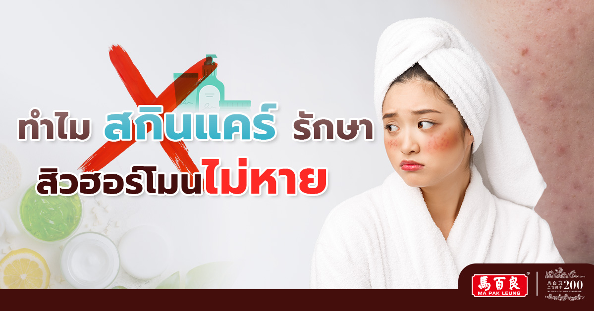 ทำไมสกินแคร์รักษาสิวฮอร์โมนไม่หาย? เผยเคล็ดลับรักษาสิวด้วยวิธีปรับสมดุลฮอร์โมน