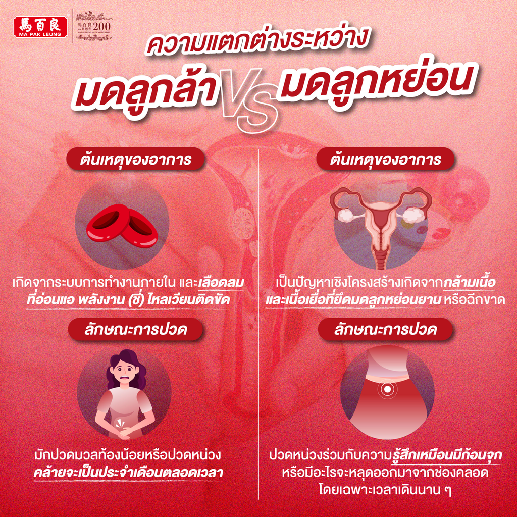ภาพความแตกต่างระหว่าง มดลูกล้า และมดลูกหย่อย มีอธิบายต้นเหตุของอาการ และลักษณะของการปวด แต่ละแบบ